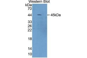 Western blot analysis of the recombinant protein. (CAMK1 Antikörper  (AA 1-370))
