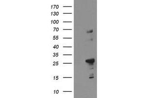 Image no. 1 for anti-Spastic Paraplegia 7 (SPG7) (AA 300-573) antibody (ABIN1491376)