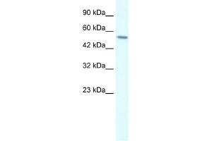 WB Suggested Anti-RGS6 Antibody Titration:  0.