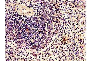 Immunohistochemistry of paraffin-embedded human spleen tissue using ABIN7165052 at dilution of 1:100 (ZBTB8OS Antikörper  (AA 2-136))