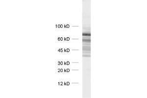 dilution: 1 : 1000, sample: synaptic vesicle fraction of rat brain (LP2) (Synapsin III Antikörper  (AA 417-434))