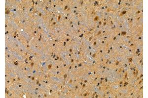 ABIN6264484 and ABIN6276976 at 1/100 staining Mouse brain tissue by IHC-P.