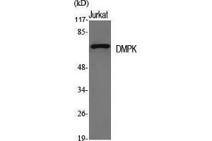 Western Blotting (WB) image for anti-Dystrophia Myotonica-Protein Kinase (DMPK) (N-Term) antibody (ABIN3174775) (DMPK Antikörper  (N-Term))