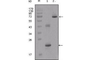 Western Blot showing IGFBP2 antibody used against truncated IGFBP2-His recombinant protein (1) and truncated IGFBP2 (aa40-328)-hIgGFc transfected CHO-K1 cell lysate (2). (IGFBP2 Antikörper  (AA 180-328))