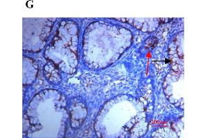 Immunofluorescence (Paraffin-embedded Sections) (IF (p)) image for anti-Secreted Protein, Acidic, Cysteine-Rich (Osteonectin) (SPARC) (AA 101-200) antibody (ABIN738141)