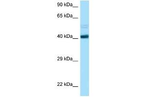 WB Suggested Anti-CCNB2 AntibodyTitration: 1.