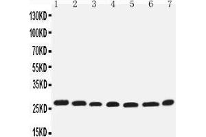 Western Blotting (WB) image for anti-Eukaryotic Translation Initiation Factor 6 (EIF6) (AA 82-96), (Middle Region) antibody (ABIN3044059) (EIF6 Antikörper  (Middle Region))