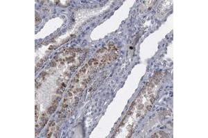 Immunohistochemical staining of human kidney with MYO18B polyclonal antibody  shows moderate cytoplasmic positivity in renal tubules. (MYO18B Antikörper)