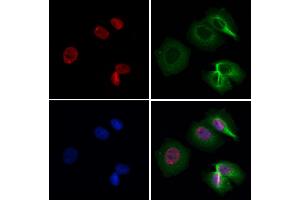 ABIN6258503 and ABIN6274617 staining Hela by IF/ICC. (CDCA7 Antikörper  (Internal Region))