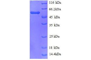 SDS-PAGE (SDS) image for Carbonyl Reductase 1 (CBR1) (AA 2-277), (full length) protein (GST tag) (ABIN1046764)