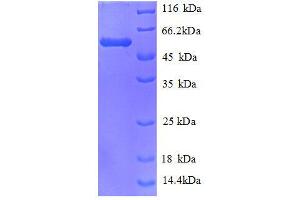 Carbonyl Reductase 1 (CBR1) (AA 2-277), (full length) protein (GST tag)