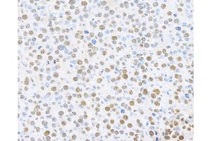 Immunohistochemistry (IHC) image for anti-Proliferating Cell Nuclear Antigen (PCNA) (C-Term) antibody (ABIN7455223)