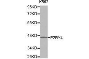Western Blotting (WB) image for anti-Pyrimidinergic Receptor P2Y, G-Protein Coupled, 4 (P2RY4) antibody (ABIN1874015) (P2RY4 Antikörper)