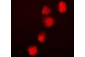Immunofluorescent analysis of BRG1 staining in Hela cells. (SMARCA4 Antikörper)