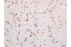 Formalin-fixed and paraffin embedded rat brain labeled with Rabbit Anti-MCHR Polyclonal Antibody, Unconjugated (ABIN719051) at 1:200 followed by conjugation to the secondary antibody and DAB staining (MCHR1 Antikörper  (AA 75-180))