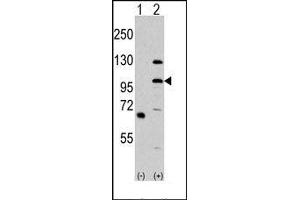 Image no. 1 for anti-Mitogen-Activated Protein Kinase Kinase Kinase MLK4 (KIAA1804) (N-Term) antibody (ABIN360429) (MLK4 Antikörper  (N-Term))