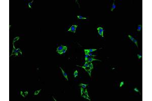 Immunofluorescence staining of MCF-7 cells with ABIN7167210 at 1:100, counter-stained with DAPI. (MRAS Antikörper  (AA 1-205))