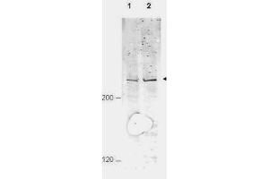 Western blot using  Affinity Purified anti-APC1 pS377 antibody shows detection of a band ~215 kDa corresponding to phosphorylated human APC1 (arrowhead). (APC1 Antikörper  (pSer377))