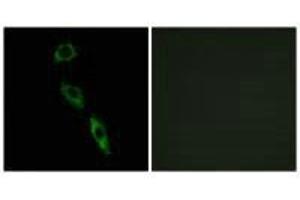 Immunofluorescence analysis of A549 cells, using ERAS antibody. (ERAS Antikörper  (C-Term))