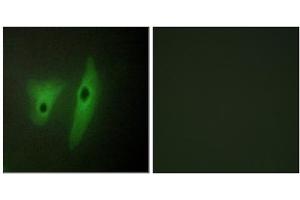 Immunofluorescence analysis of HeLa cells, using DUS19 antibody. (DUSP19 Antikörper  (Internal Region))