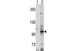 Western Blotting (WB) image for anti-EPH Receptor A7 (EPHA7) antibody (ABIN3003338) (EPH Receptor A7 Antikörper)