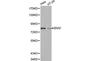Western blot analysis of extracts of various cell lines, using BRAF antibody. (BRAF Antikörper)
