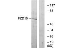 Western Blotting (WB) image for anti-Frizzled Family Receptor 10 (FZD10) (AA 135-184) antibody (ABIN2890778) (FZD10 Antikörper  (AA 135-184))