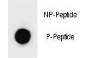 Dot blot analysis of p-PARP1 antibody. (PARP1 Antikörper  (pSer41))