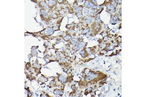 Immunohistochemistry of paraffin-embedded rat liver using SLC14 Rabbit pAb (5991) at dilution of 1:200 (40x lens).