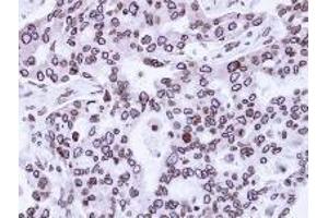 Immunohistochemistry: Lamin A/C antinbody staining of Paraffin-Embedded H441 Xenograft at 1/100 dilution. (Lamin A/C Antikörper  (AA 59-249))