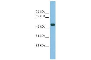 WB Suggested Anti-TFB2M Antibody Titration: 0. (TFB2M Antikörper  (N-Term))