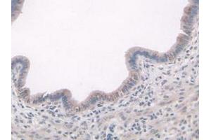 Detection of ADAMTS7 in Mouse Uterus Tissue using Polyclonal Antibody to A Disintegrin And Metalloproteinase With Thrombospondin 7 (ADAMTS7) (ADAMTS7 Antikörper  (AA 226-437))