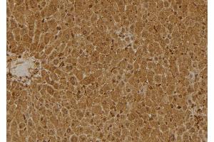 Immunohistochemistry (IHC) image for anti-serpin Peptidase Inhibitor, Clade B (Ovalbumin), Member 9 (SERPINB9) (Internal Region) antibody (ABIN6258410)