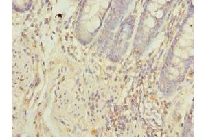 Immunohistochemistry of paraffin-embedded human colon tissue using ABIN7162093 at dilution of 1:100