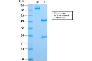 SDS-PAGE Analysis Purified CD6 Rabbit Recombinant Monoclonal Antibody (C6/2884R). (Rekombinanter CD6 Antikörper)