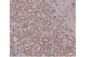 Immunohistochemistry (IHC) image for anti-Fibroblast Growth Factor 1 (Acidic) (FGF1) (AA 16-155) antibody (ABIN7427030)