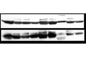 Image no. 5 for anti-Nuclear Factor-kB p65 (NFkBP65) (pSer276) antibody (ABIN1103942) (NF-kB p65 Antikörper  (pSer276))