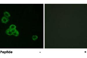 Immunofluorescence analysis of MCF-7 cells, using CAMK2A/CAMK2D polyclonal antibody . (CAMK2A Antikörper)