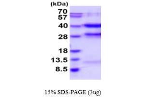 PPP1CC Protein (AA 1-323) (His tag)