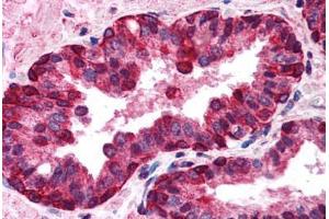 Human Prostate (formalin-fixed, paraffin-embedded) stained with IRF3 antibody ABIN213923 at 5-10 ug/ml followed by biotinylated goat anti-rabbit IgG secondary antibody ABIN481713, alkaline phosphatase-streptavidin and chromogen. (IRF3 Antikörper  (C-Term))