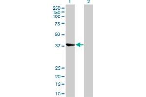 Western Blot analysis of RBCK1 expression in transfected 293T cell line by RBCK1 MaxPab polyclonal antibody. (RBCK1 Antikörper  (AA 1-230))