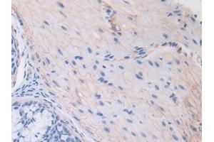 Immunohistochemistry (IHC) image for anti-Thrombospondin 1 (THBS1) (AA 515-671) antibody (ABIN7438112)
