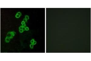 Immunofluorescence analysis of MCF7 cells, using EDG2 Antibody. (BUD31 Antikörper  (AA 5-54))