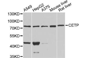 Western blot analysis of extracts of various cell lines, using CETP antibody. (CETP Antikörper)
