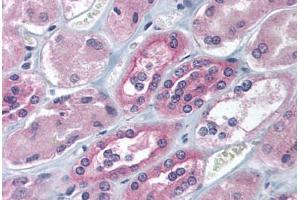 Immunohistochemistry (IHC) image for anti-Insulin-Like Growth Factor 2 mRNA Binding Protein 1 (IGF2BP1) (AA 155-204) antibody (ABIN6736731)