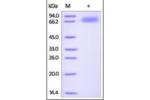 Human ALCAM, His Tag on SDS-PAGE under reducing (R) condition. (CD166 Protein (AA 28-526) (His tag))