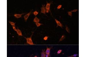 Immunofluorescence analysis of NIH-3T3 cells using UFC1 Polyclonal Antibody at dilution of 1:100 (40x lens).