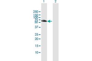 Western Blot analysis of HCK expression in transfected 293T cell line by HCK MaxPab polyclonal antibody.