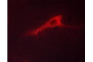 Immunofluorescence (fixed cells) (IF/ICC) image for anti-Adducin 1 (Alpha) (ADD1) (pSer726) antibody (ABIN6255485)