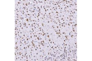 IHC analysis of Optineurin using anti-Optineurin antibody (ABIN3042498).